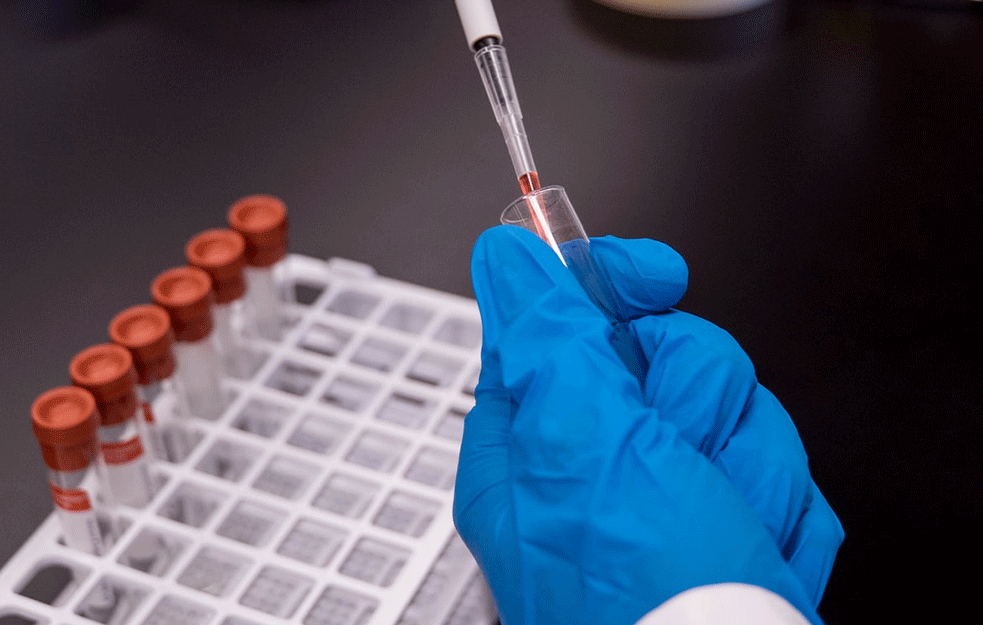 EPIDEMIJA MALIH BOGINJA KOSI SVE PRED SOBOM : U <span style='color:red;'><b>Zimbabve</b></span>u umrlo 157 dece