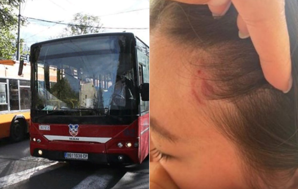 Kontrolorka BRUTALNO PRETUKLA ženu u javnom prevozu: '<span style='color:red;'><b>Busplus</b></span>' potvrdio da je u toku OPSEŽNA ISTRAGA (FOTO)  