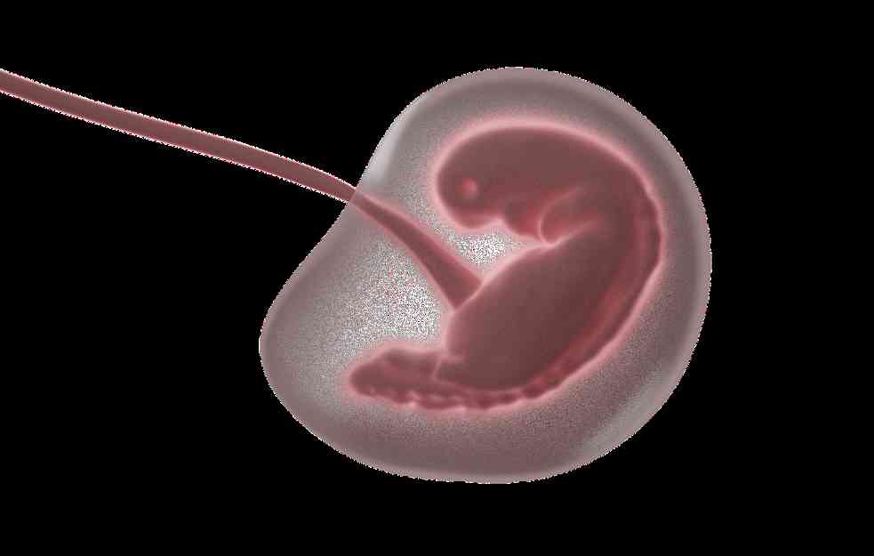 KORISTE ŽIVU ABORTIRANU DECU ZBOG BUBREGA! Šokantno otkriće dr Nestorovića o pobačajima (VIDEO)