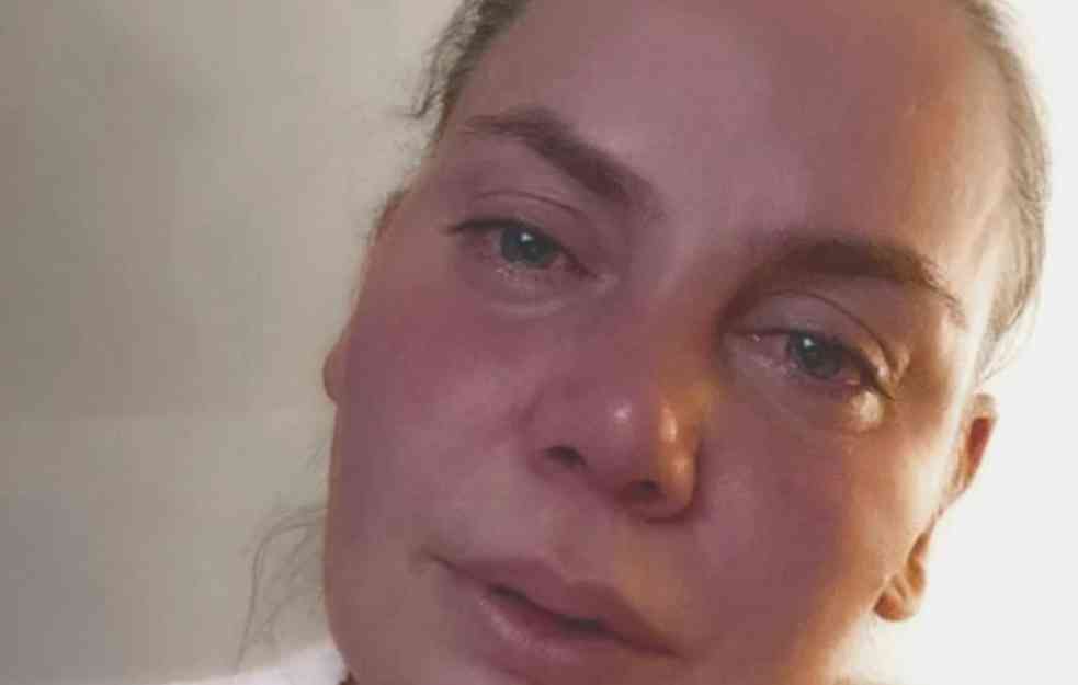 PAKAO JELENE DOKIĆ : Bivša teniserka sva u modricama iz strašnog razloga, ovo je NEHUMANO! (FOTO)