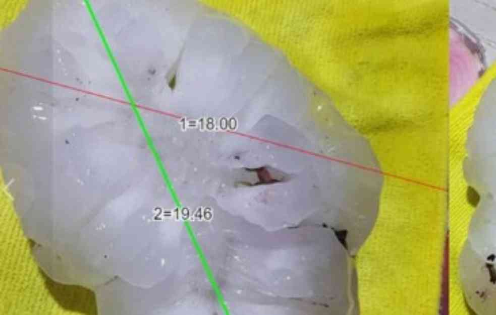 OVO JE REKORDNA VELIČINA GRADA KOJI JE PADAO U ITALIJI: Ledene bombe od čak 19 centimetara! NEVEROVATNO! (FOTO)