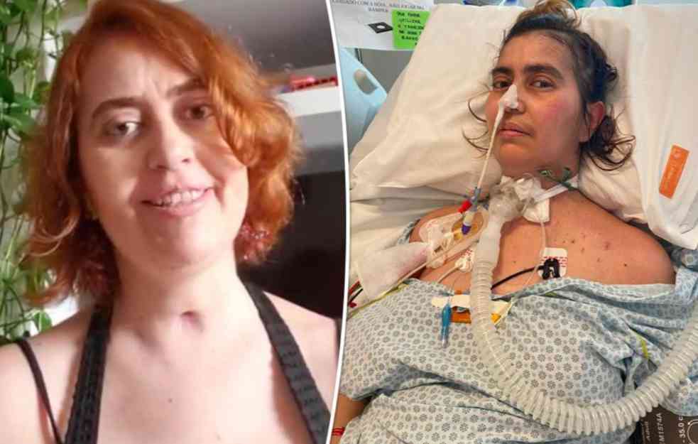 GLOBALNA UZBUNA: SMRTONOSNA epidemija botulizma širi se velikom brzinom i ČAK IZAZIVA PARALIZU!