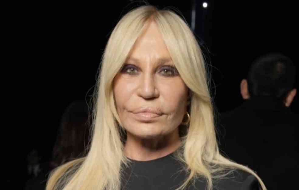 DONATELA VERSAĆE IZGLEDALA JE KAO ANĐEO, A ONDA JE OTIŠLA POD NOŽ:  Ovako sad izgleda (VIDEO)