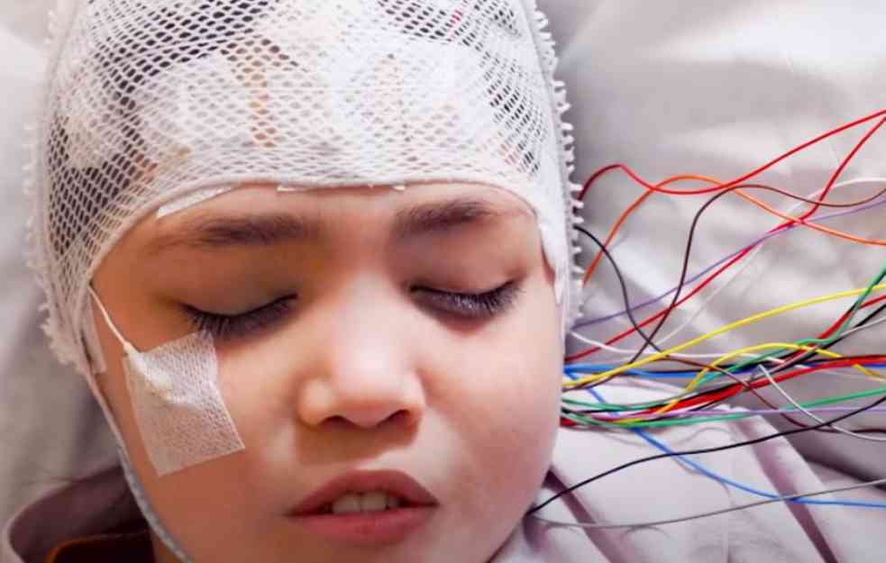 OVO SU SIMPTOMI EPILEPSIJE: Evo kako se leči neurološki poremećaj koji u Srbiji ima 70.000 ljudi