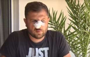 TEŠKO PRETUČEN SRBIN! ĐOŠIĆ: <span style='color:red;'><b>Komšija</b></span> Albanac me napao u prisustvu deteta! Nema nama ovde zaštite!