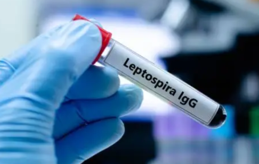 Deset osoba sa simptomima leptospiroze primljeno na liječenje u Sarajevu