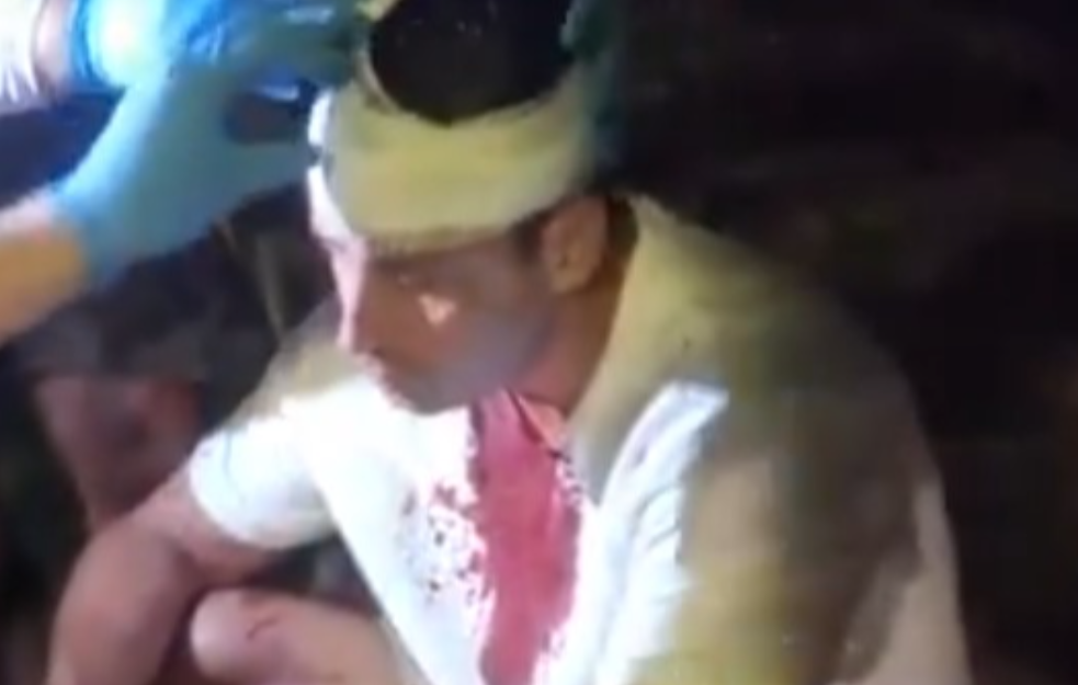 Udaran šipkom po glavi i telu: Pretučen poslanik SSP Predrag Mitrović (VIDEO)