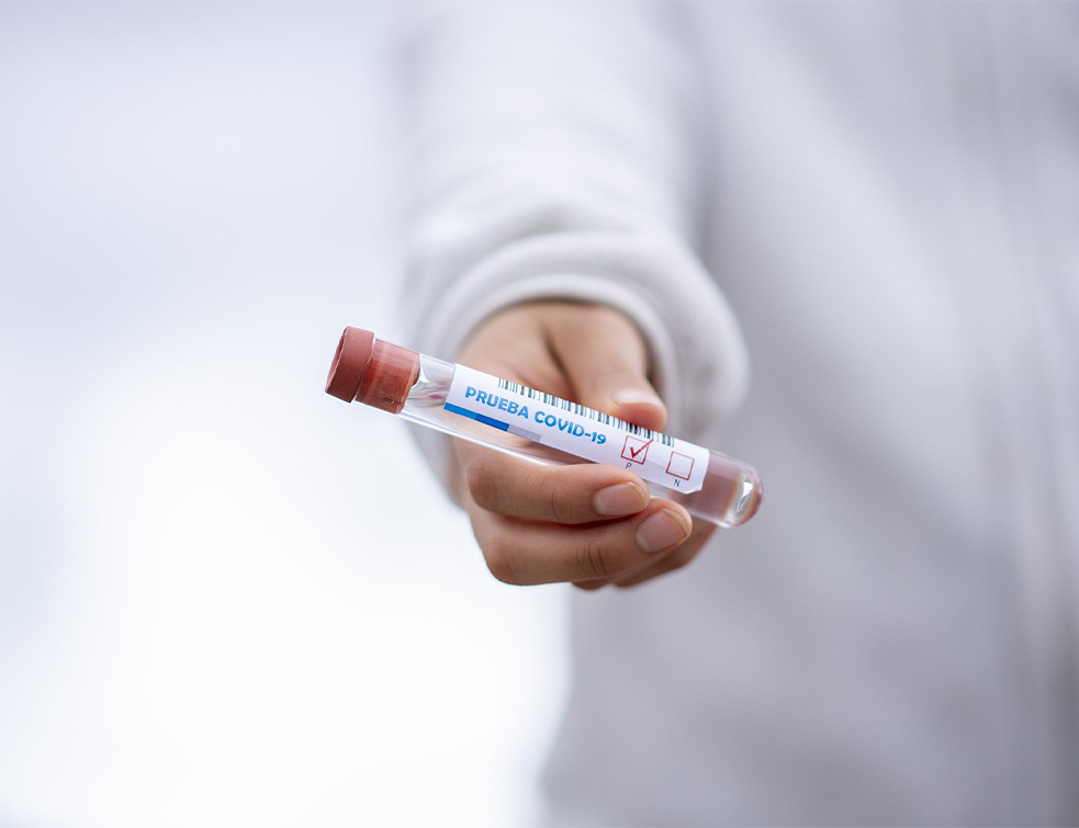 <span style='color:red;'><b>Srpski virus</b></span>olog: Koliko su zaštićeni oni koji su se oporavili od korone?