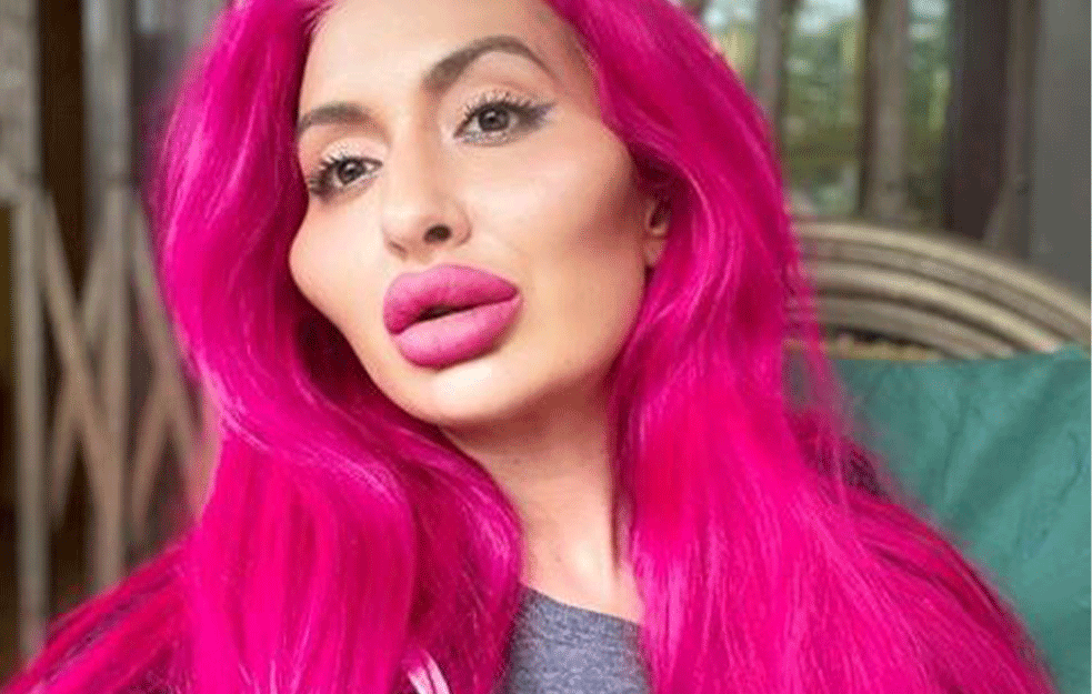 BILA JE TAKO LEPA:  Šta mislite kako je nekad izgledala najružnija devojka Instagrama?

