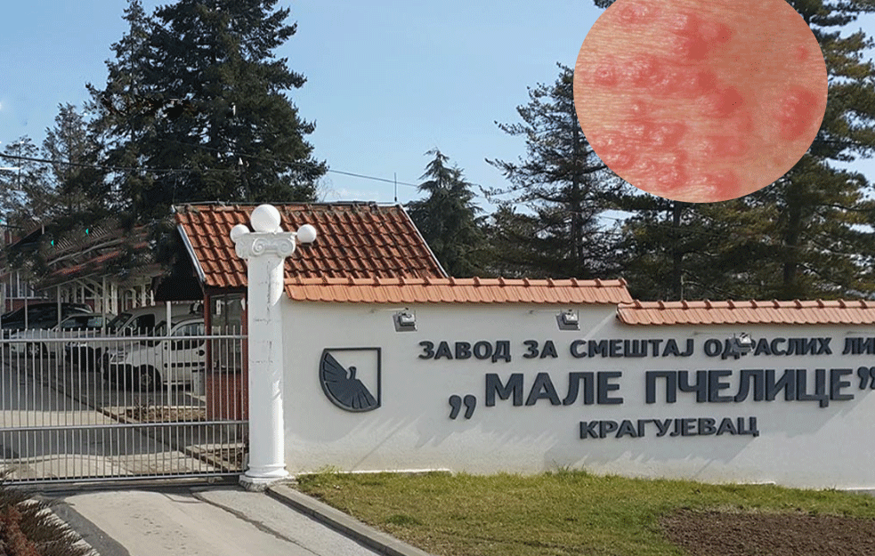LEČIO LJUDE LEKOM ZA STOKU: Uhapšen direktor <span style='color:red;'><b>doma za stare</b></span> u Kragujevcu zbog pojave šuge!