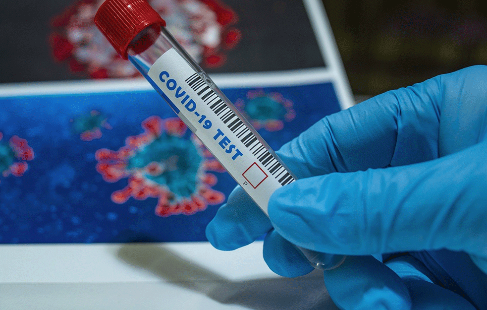 DANAS JEDNOCIFREN BROJ PREMINULIH: Zvanično 4.582 nova slučaja koronavirusa