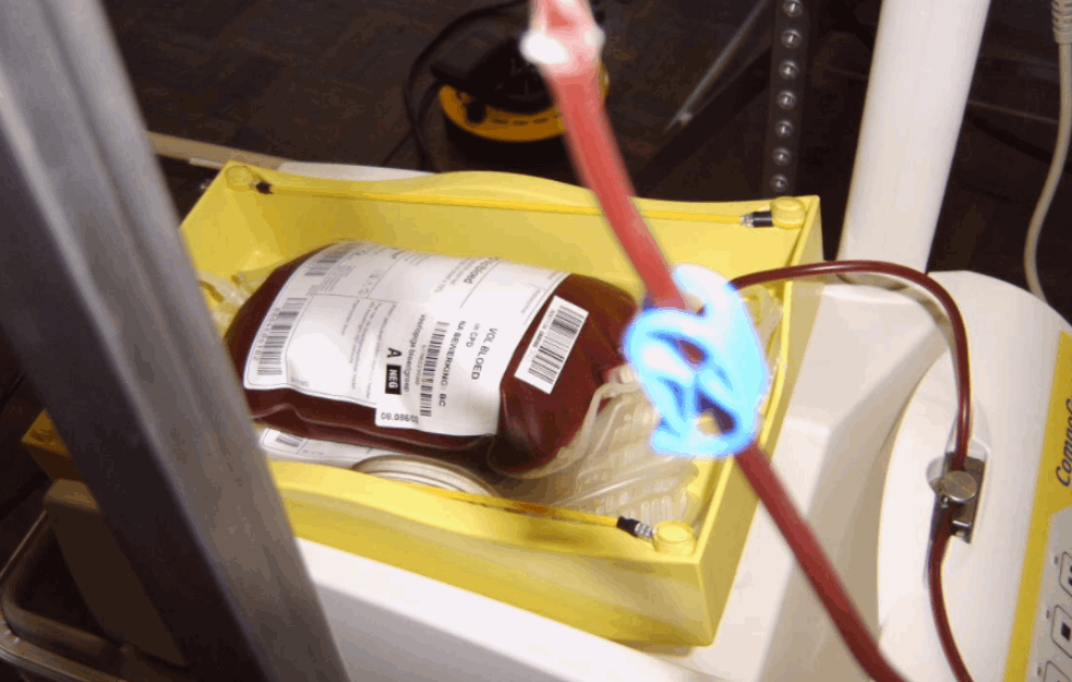 POVEĆAN BROJ OPERACIJA U SRBIJI: Pomognite i dajte krv