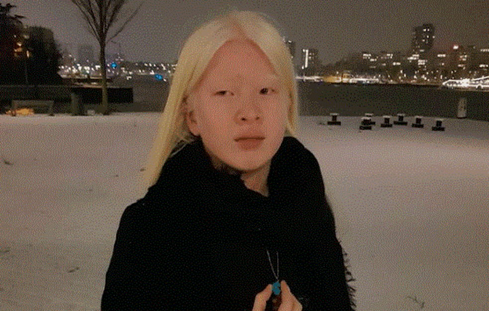 ZBOG IZGLEDA RODITELJI SU JE KAO BEBU OSTAVILI U SIROTIŠTU: Danas je USPEŠNA i  osvanula je na naslovnici VOGA! 



