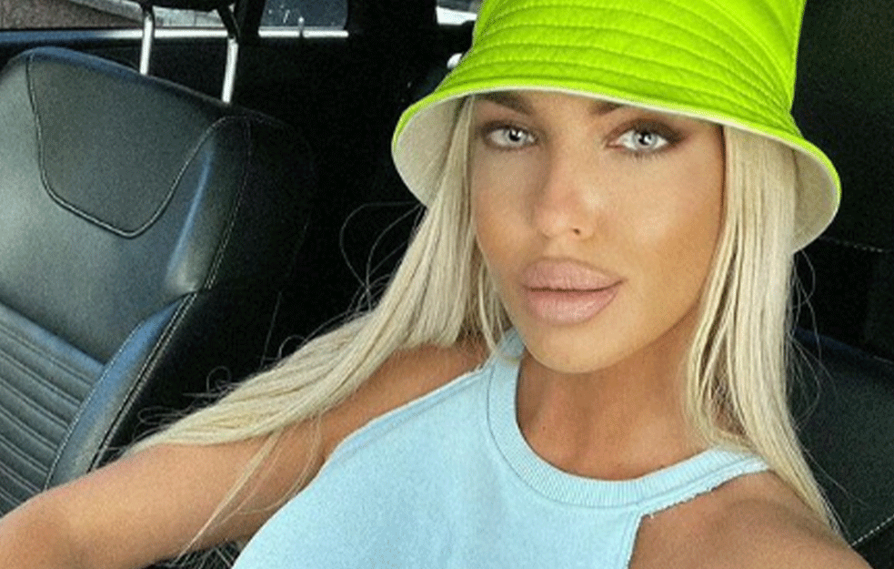 JEDVA IZVUKLA ŽIVU GLAVU! Karleuša počela da se guši posle ujeda ose, završila na Urgentnom! (FOTO)