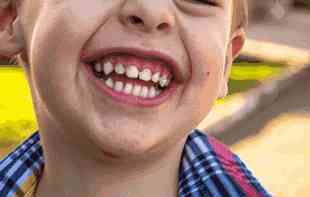 Poslušajte savet stomatologa koja je najgora hrana za dečije zube