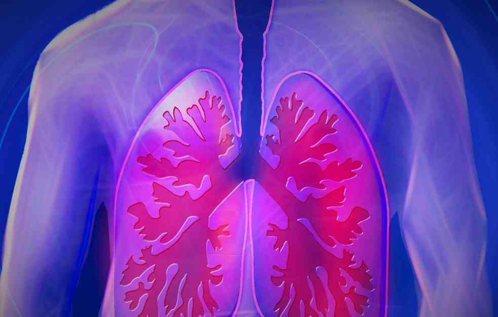 DR STJEPANOVIĆ OTKRIVA: Ovaj simptom ljudi često zanemare, a može biti prvi znak za rak pluća! 