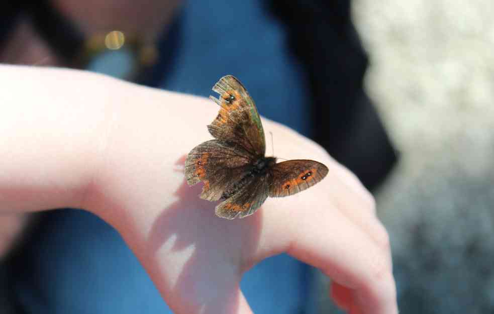 NAUČNICI NA PRAGU REVOLUCIONARNOG OTKRIĆA: Proizveden gel koji bi mogao da leči bolest "dece leptira"