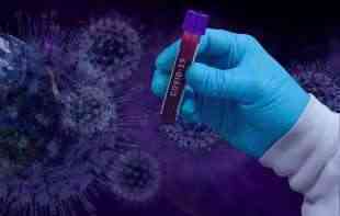 PONOVO DEVET PREMINULIH: Zvanično 1.063 nova slučaja koronavirusa