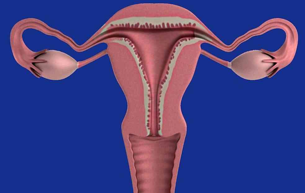 OTKRIVENI UZORCI NASTANKA RAKA JAJNIKA : Preventiva i zaštita savetuju stručnjaci