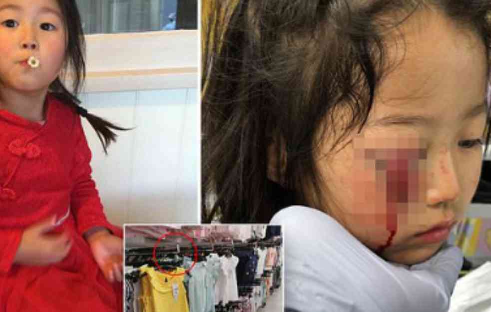 Bizaran incident u butiku umalo koštao oka devojčicu (6)