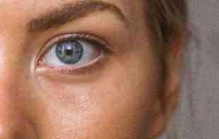 PRESTAĆETE ODMAH OVO DA RADITE: Zašto je često trljanje očiju toliko loša navika?