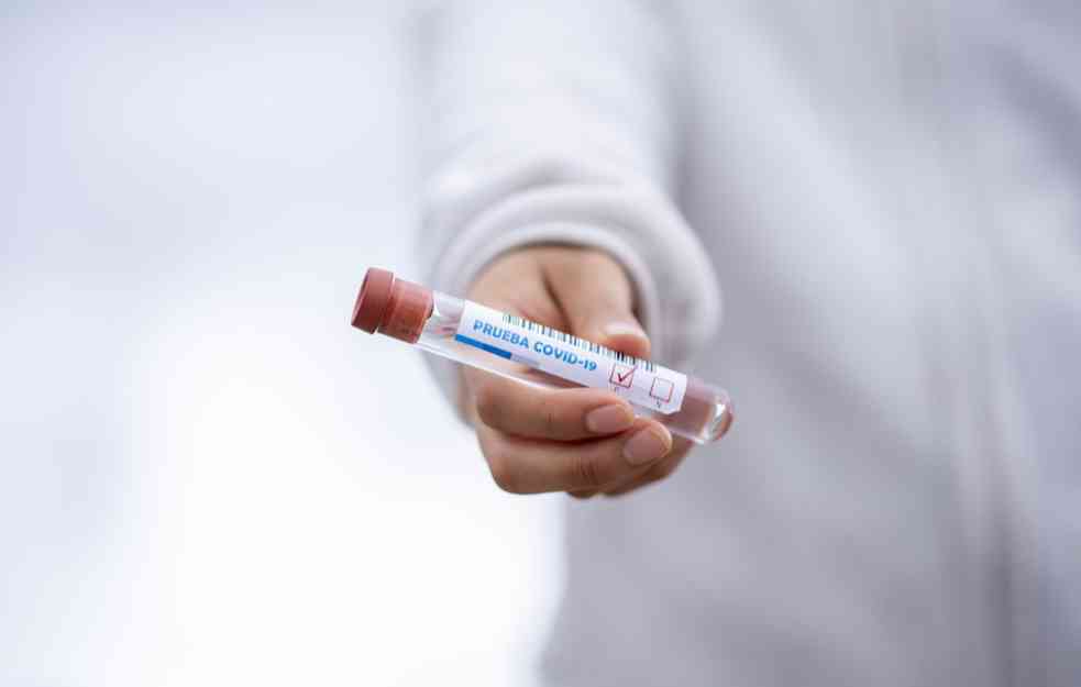 BROJKE SVE MANJE I MANJE: Zvanično 482 nova slučaja koronavirusa, preminule četiri osobe