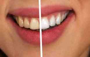 EVO KOJI TRIK JE U PITANJU: Kako da izbelite zube prirodnim putem?