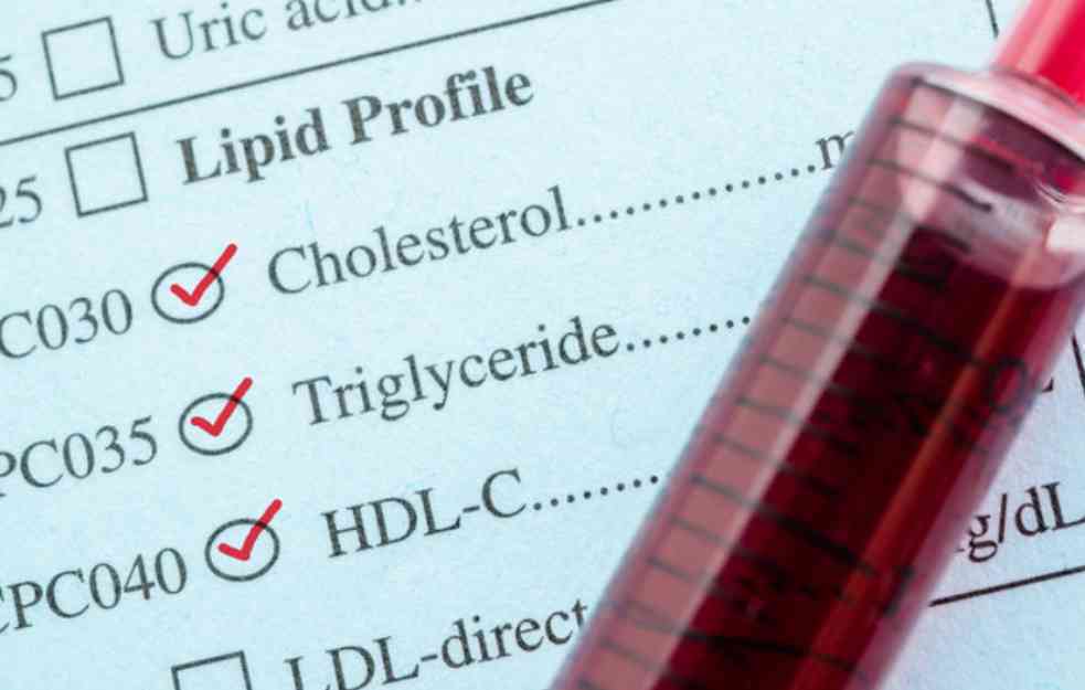 RAZBIJANJE MITOVA: Zašto holesterol u hrani nije štetan po zdravlje 