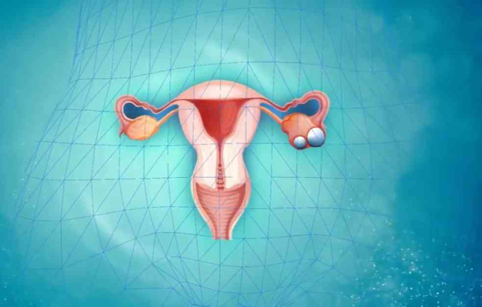 STRAŠNO! U Srbiji od RAKA JAJNIKA godišnje oboli oko 800 žena! Svakog dana jedna UMRE od ove opake bolesti!