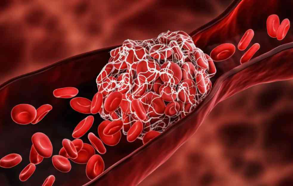 Povišen bilirubin u krvi ukazuje na problem sa dva organa u telu