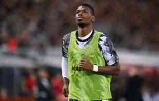 POGBA: Kosa mi je opadala od stresa
