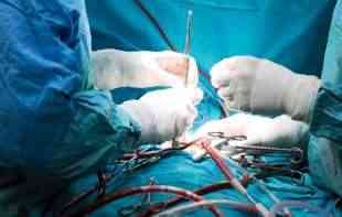 U Nišu odrađena operacija smanjenja želuca robotskim staplerskim uređajem