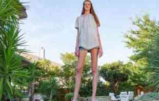 Noge od 132 centimetara: Devojka džin!!!