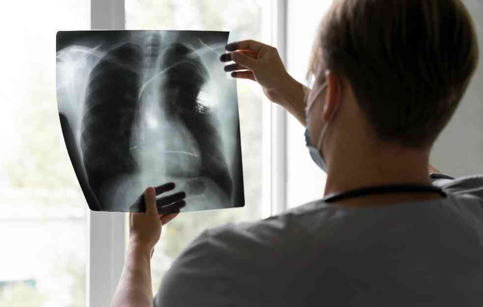 Prvi simptom raka pluća nije kašalj, ali na njega niko ne obraća pažnju