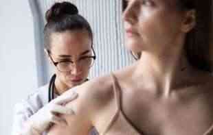 Mesec borbe protiv melanoma: Godišnje u Srbiji od raka kože oboli 7.000 ljudi
