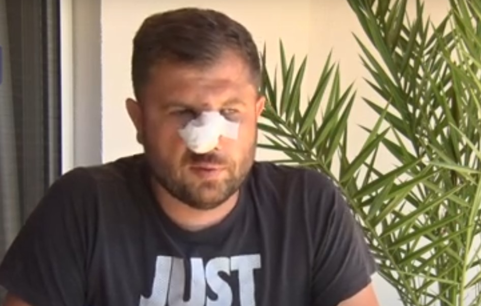 TEŠKO PRETUČEN SRBIN! ĐOŠIĆ: Komšija Albanac me napao u prisustvu deteta! Nema nama ovde zaštite!