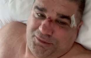 Saša Mirković se oglasio iz bolnice: Imao tešku operaciju, pa se obratio na sveti dan!