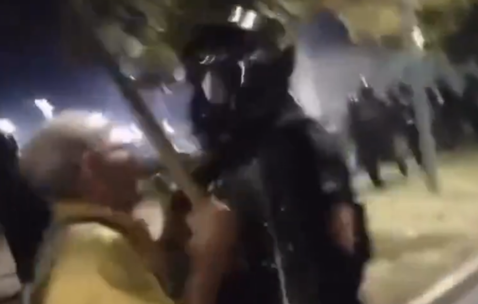 (VIDEO) Stariji muškarac kojeg je žandarm gurnuo pokazao povrede, sav slomljen