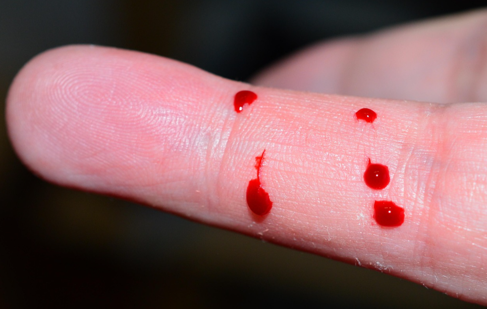 Ovo su znakovi da imate začepljenje arterije